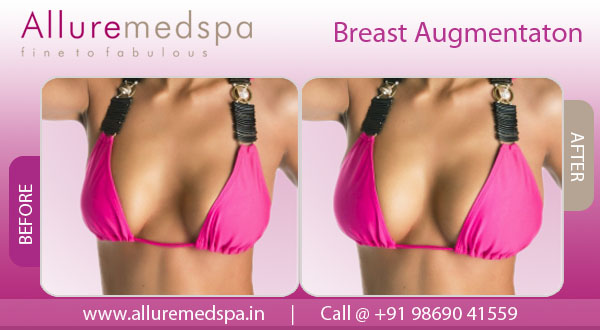 breast augmentation mumbai india