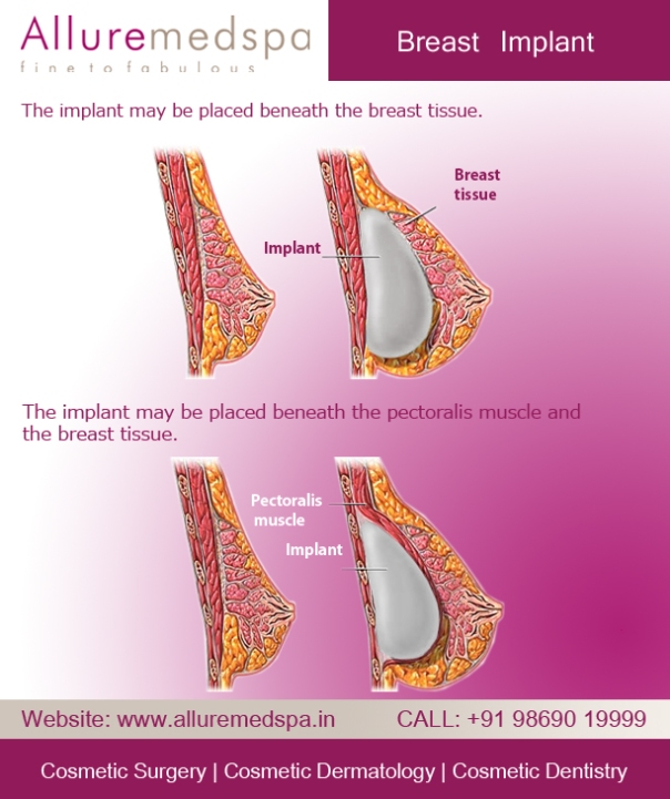 breast augmentation mumbai india